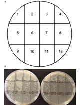 Quantification of Neisseria meningitidis Adherence to Human  Epithelial Cells by Colony Counting