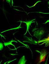 Culture and Nucleofection of Postnatal Day 7 Cortical and Cerebellar Mouse Astroglial Cells