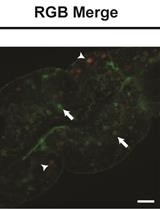 Measurement of Lysosomal Size and Lysosomal Marker  Intensities in Adult Caenorhabditis elegans