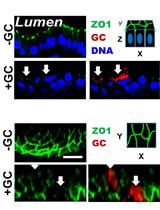 Immunofluorescence Analysis of Human Endocervical Tissue  Explants Infected with Neisseria gonorrhoeae