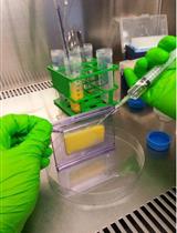 Ex vivo Analysis of Lipolysis in Human Subcutaneous Adipose Tissue Explants