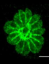 Conditional Knockdown of Proteins Using Auxin-inducible  Degron (AID) Fusions in Toxoplasma gondii