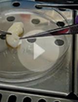 Isolation and Establishment of Mesenchymal Stem Cells from Wharton’s Jelly of Human Umbilical Cord