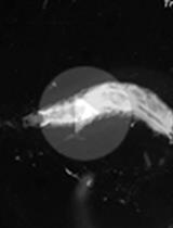 Assaying Mechanonociceptive Behavior in Drosophila Larvae