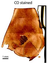 Registration and Alignment Between in vivo Functional and  Cytoarchitectonic Maps of Mouse Visual Cortex