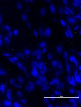 Quantification of Bacterial Attachment to Tissue Sections