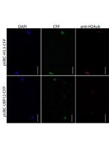 Histone Deubiquitination Assay in <em>Nicotiana benthamiana</em>