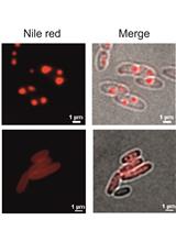 Determination of Polyhydroxybutyrate (PHB) Content in Ralstonia eutropha  Using Gas Chromatography and Nile Red Staining