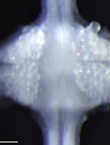 Dual-sided Voltage-sensitive Dye Imaging of Leech Ganglia