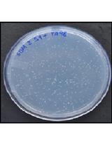 Microbial Mutagenicity Assay: Ames Test