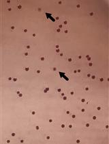 Isolation of Commensal Escherichia coli Strains from Feces of Healthy Laboratory Mice or Rats