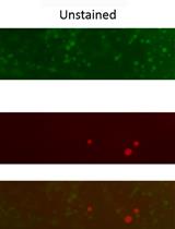 Analysis of Mitochondrial Structure in the Body Wall Muscle of Caenorhabditis elegans