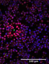 Imaging Cytokine Concentration Fields Using PlaneView Imaging Devices