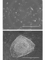 人成纤维细胞通过CRISPR 插入缺失的形成联合重编程生成功能丧失iPSC细胞系
