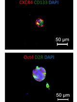 Primary Cultures from Human GH-secreting or Clinically Non-functioning Pituitary Adenomas