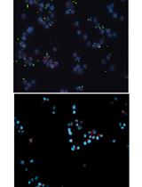 Adhesion of Enteroaggregative <em>E. coli</em> Strains to HEK293 Cells