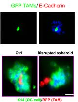 3D Co-culture System of Tumor-associated Macrophages and Ovarian Cancer Cells