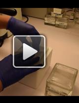 人类硬脑膜淋巴管的磁共振成像及组织病理学观察