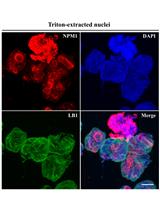 A Method for Extracting the Nuclear Scaffold from the Chromatin Network