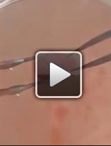 小鼠胚胎纹状体神经元的分离与维持