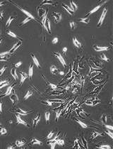 Cobblestone Area-forming Cell Assay of Mouse Bone Marrow Hematopoietic Stem Cells