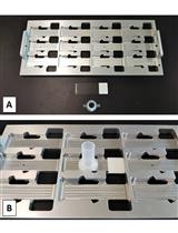 使用基于液体的细胞学检查和WT1免疫酶染色定量人尿中的足细胞和壁层上皮细胞