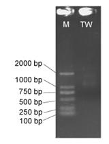 A Modified Low-quantity RNA-Seq Method for Microbial Community and  Diversity Analysis Using Small Subunit Ribosomal RNA