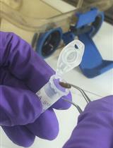 Assessing the Efficacy of Small Molecule Inhibitors in a Mouse Model of Persistent Norovirus Infection