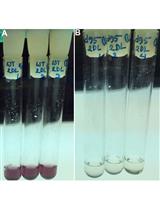 Glycogen and Extracellular Glucose Estimation from Cyanobacteria Synechocystis sp. PCC 6803
