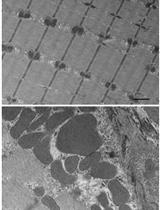 Transmission Electron Microscopy for Analysis of Mitochondria in Mouse Skeletal Muscle