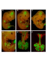 In vitro Explant Cultures to Interrogate Signaling Pathways that  Regulate Mouse Lung Development