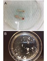 Osteoblast Sorting and Intracellular Staining of CXCL12
