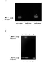 Detection of Catalase Activity by Polyacrylamide Gel Electrophoresis (PAGE) in Cell Extracts from Pseudomonas aeruginosa