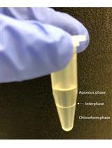 Hyaluronan Isolation from Mouse Mammary Gland