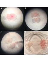 Intracellular and Mitochondrial Reactive Oxygen  Species Measurement in Primary Cultured Neurons