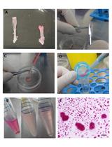 In vitro Osteoclastogenesis Assays Using Primary Mouse Bone Marrow Cells