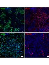 Small Molecule-Based Retinal Differentiation of Human Embryonic  Stem Cells and Induced Pluripotent Stem Cells