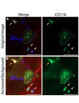 Immunohistochemical Identification of Human Skeletal Muscle Macrophages