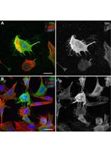 Preserve Cultured Cell Cytonemes through a Modified Electron Microscopy Fixation