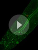 FRAP: A Powerful Method to Evaluate Membrane Fluidity in Caenorhabditis elegans