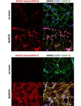Preparation of Cerebellum Granule Neurons from Mouse or Rat Pups and Evaluation of Clostridial Neurotoxin Activity and Their Inhibitors by Western Blot and Immunohistochemistry