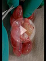 Embryonic Intravitreous Injection in Mouse