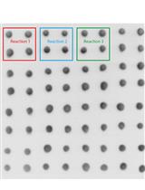In vitro Enzymatic Assays of Histone Decrotonylation on Recombinant Histones