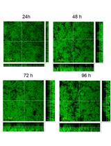 Structural Analysis of Bordetella pertussis Biofilms by  Confocal Laser Scanning Microscopy