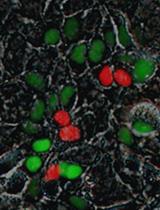 HCV Reporter System (Viral Infection-Activated Split-Intein-Mediated  Reporter System) for Testing Virus Cell-to-cell Transmission ex-vivo