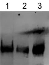 Deoxycholate Fractionation of Fibronectin (FN) and Biotinylation Assay to Measure Recycled FN Fibrils in Epithelial Cells