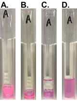 Liposome Flotation Assay for Studying Interactions Between Rubella Virus Particles and Lipid Membranes