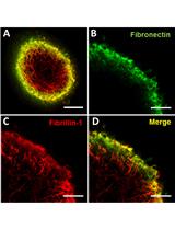 Generation of Human Mesenchymal Stem Cell 3D Spheroids Using Low-binding Plates