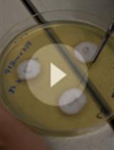 Artificial Inoculation of <em>Epichloë festucae</em> into <em>Lolium perenne</em>, and Visualisation of Endophytic and Epiphyllous Fungal Growth