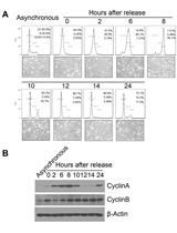 Cell Synchronization by Double Thymidine Block